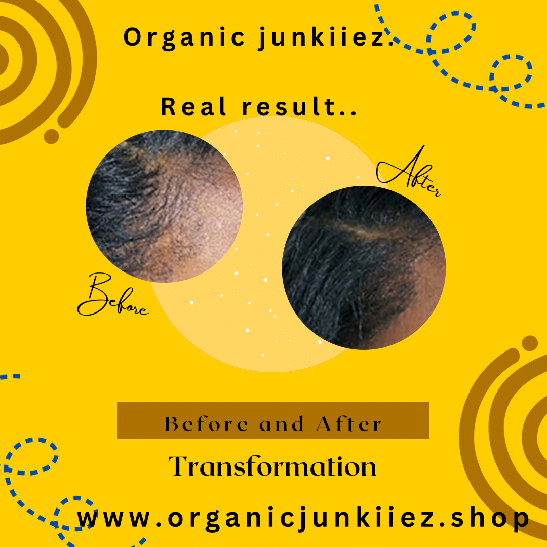 ORGANIC JUNKIIEZ HAIR CRACK ORGANIC JUNKIIEZ
